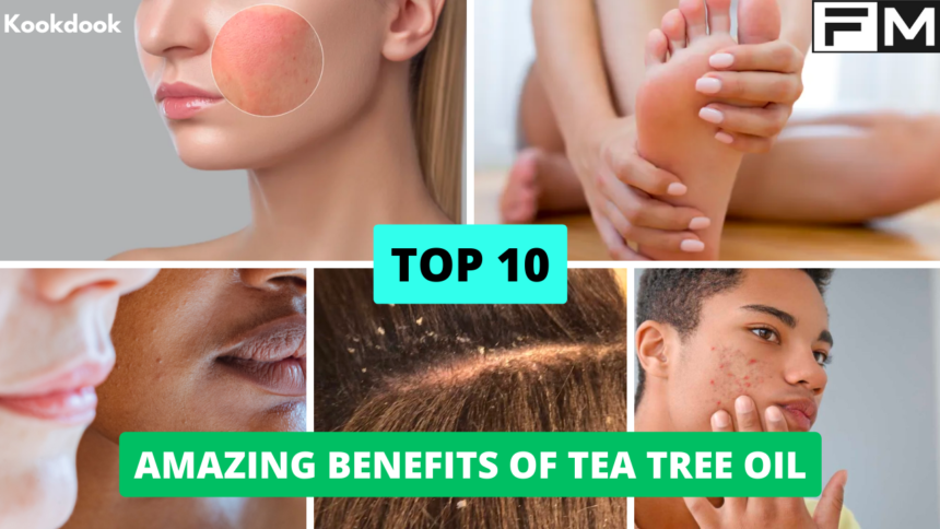 10 Amazing Benefits of Tea Tree Oil Benefits of Tea Tree Oil,uses of tea tree oil,tea tree oil,aromatherapy